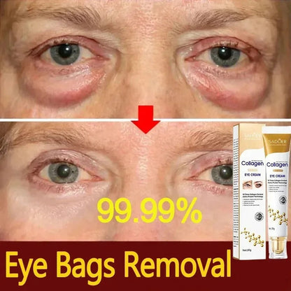 Eye Bag Removal Cream